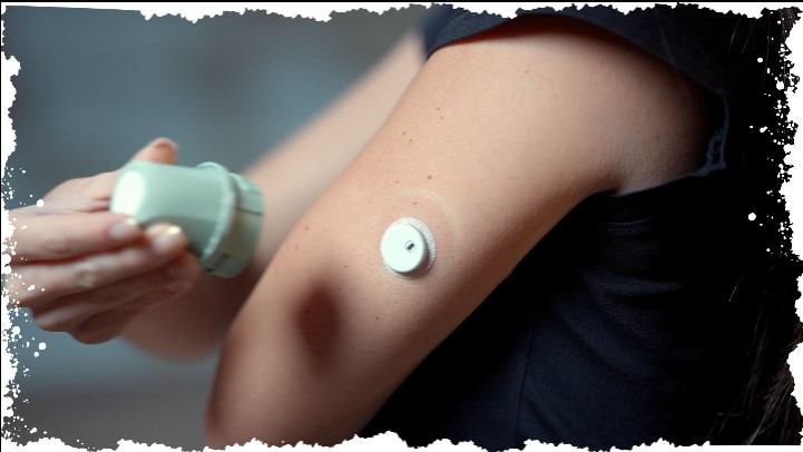 Welcome to Aidex CGM: Revolutionizing Continuous Glucose Monitoring with the Power of the Aidex Sensor